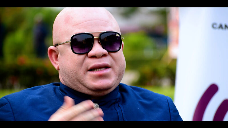 LA SITUATION DES PERSONNES AVEC ALBINISME AU CONGO